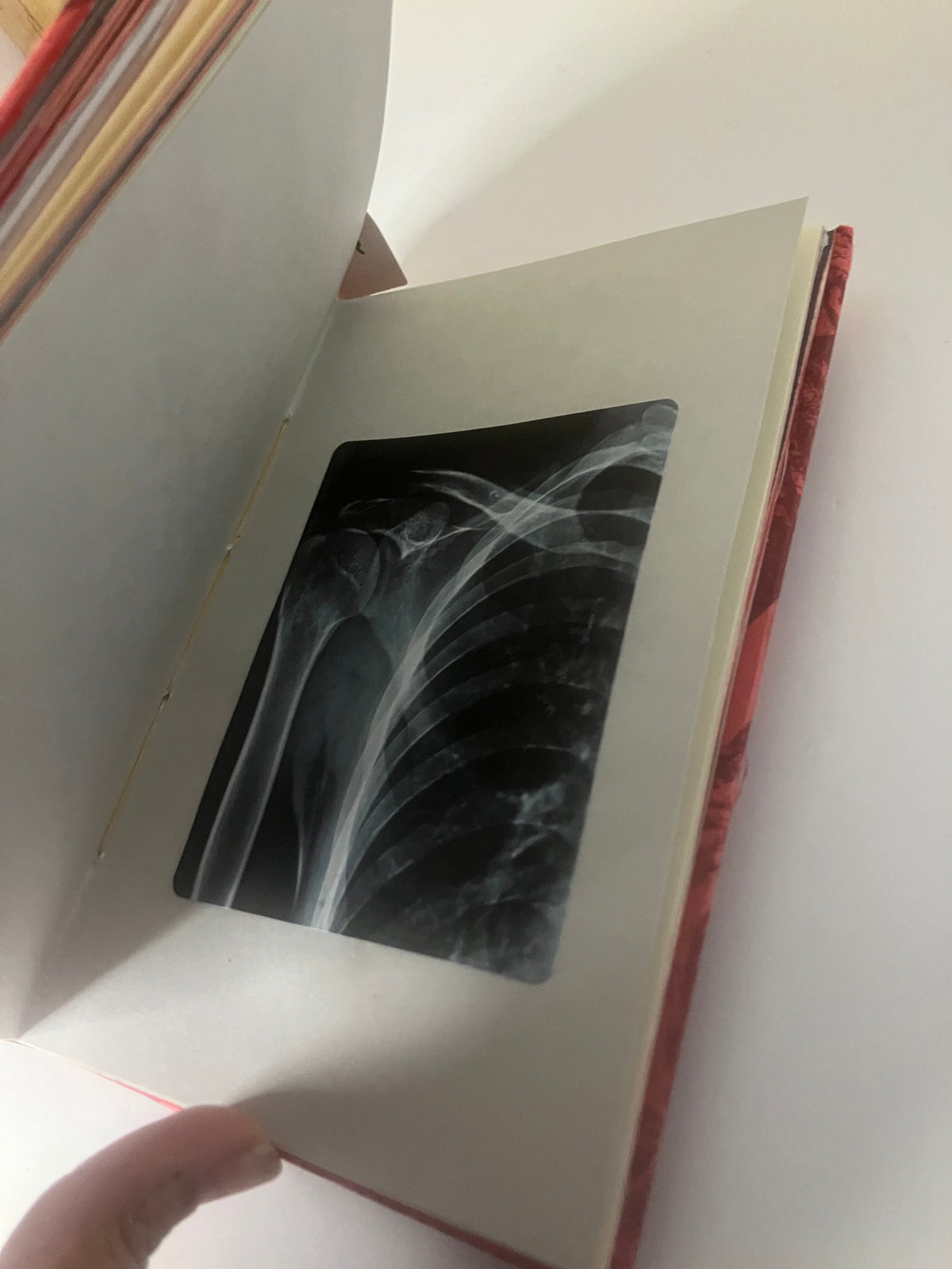 Shoulder X-ray image on a cream page inside the red journal